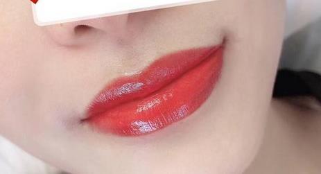 唇部外翻矯正后的注意事項有哪些?唇部外翻整形手術(shù)果如何?