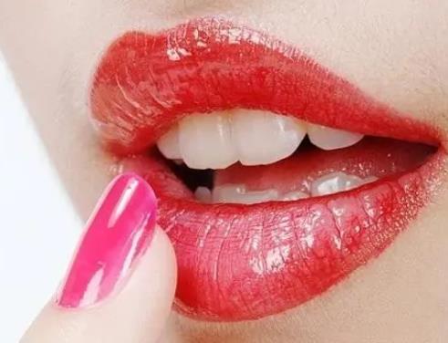 唇部外翻矯正有哪些方法?造成露齦笑的原因有哪些呢?