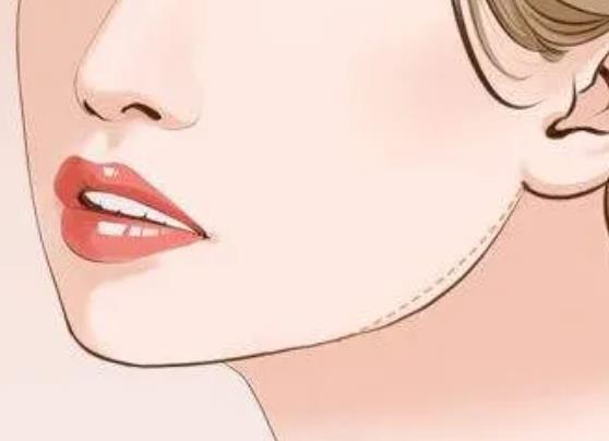 下頜角肥胖的女性整形方法有哪些?下頜角肥胖對(duì)臉的影響有多大?