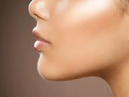 什么的下頜角是每個人都喜歡的下頜角?下頜角手術(shù)恢復期有多長?