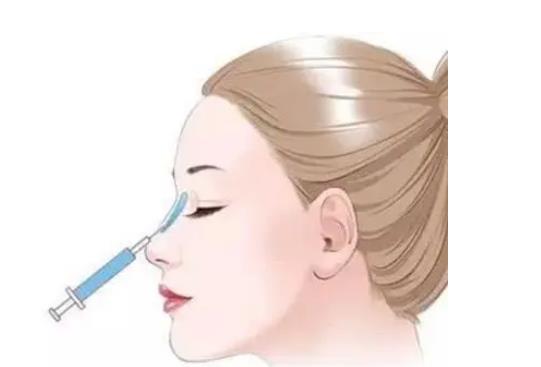 玻尿酸隆鼻適合鼻子太低的人嗎?