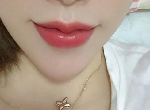 豐唇的果不能長(zhǎng)時(shí)間維持的原因是什么?