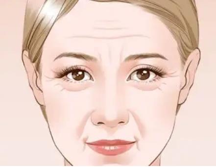 法令紋用脂肪填充可以管多長時間,果怎么樣?