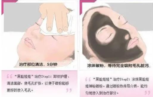 黑臉娃娃收縮毛孔的成本是多少?影響因素是什么