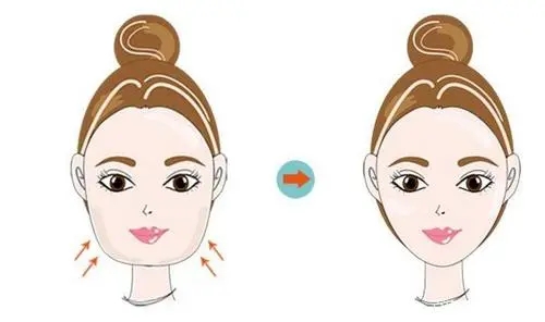 面部吸脂后為什么要戴頭罩?抽脂后如何戴頭套?