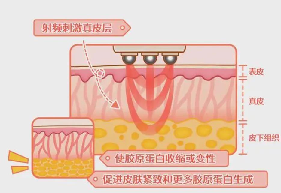 做熱瑪吉有什么反應(yīng)?