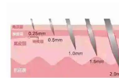做完微針什么時(shí)候可以洗臉，做完微針有哪些注意事項(xiàng)?