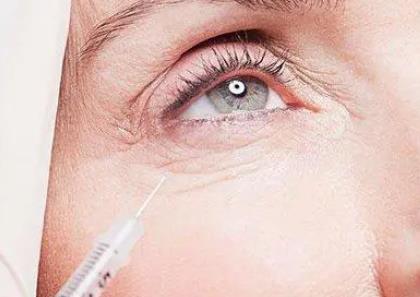 自體脂肪填充眼窩的怎么樣?