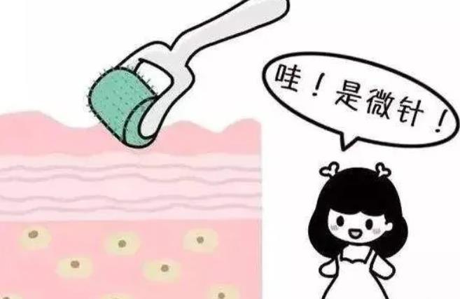 需要多長時間才能看到微針去除痘坑的果?