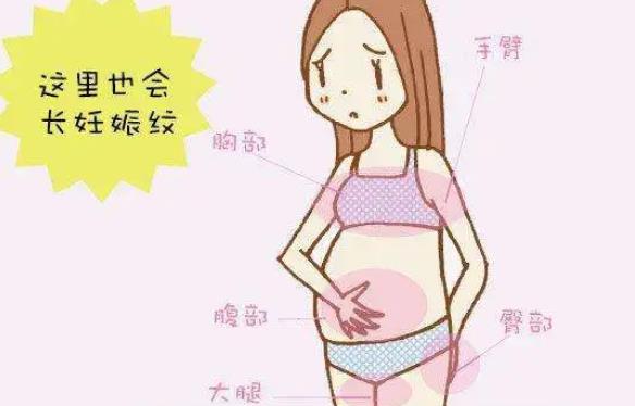 去妊娠紋可以用電波拉皮嗎?