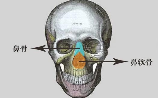 鼻骨矯正有哪些方法?