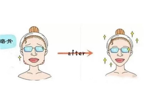 顴骨整形有哪些注意事項(xiàng)