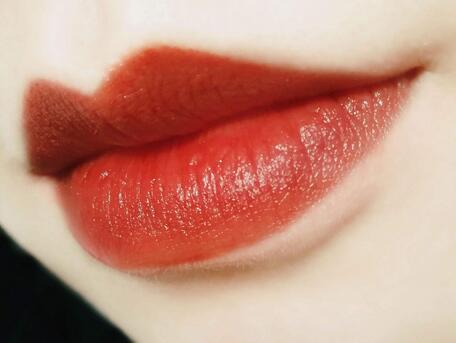 紋唇有哪些可能的后遺癥?