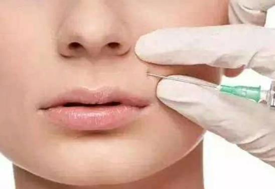 脂肪填充法令紋需要多少錢?填充果表現(xiàn)在哪？