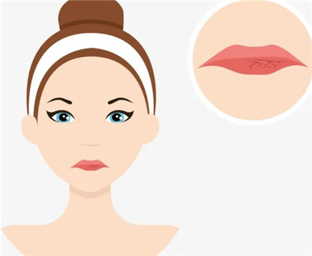 兔唇修復(fù)要花多少錢，有風(fēng)險(xiǎn)嗎