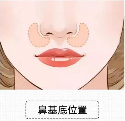 填充鼻基底好的方法有哪些?