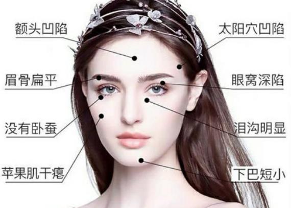 自體脂肪豐太陽穴手術前需要準備什么?