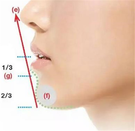 下巴整形手術的方法有哪些