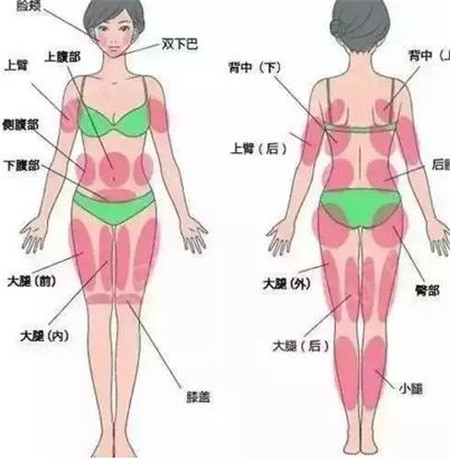 抽脂減肥適用于哪些部位?