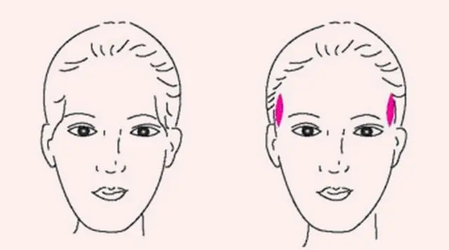 豐太陽穴是*的嗎? 豐太陽穴適用哪些人?