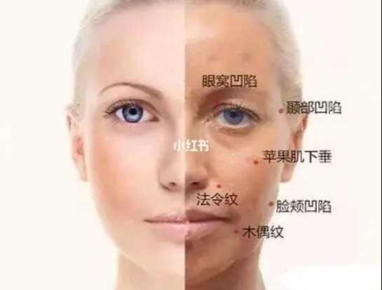 顳部填充有哪些方式和材料？顳部填充術后如何護理?