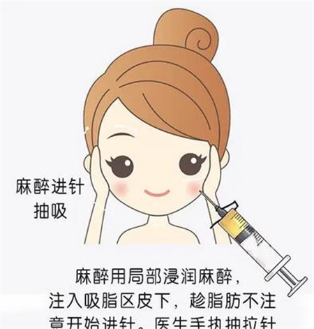 眼皮吸脂有哪些風(fēng)險(xiǎn)，術(shù)后有哪些需要注意