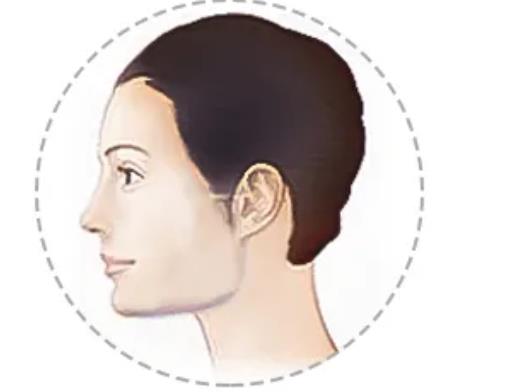 矯正顴弓肥大的方法有哪些