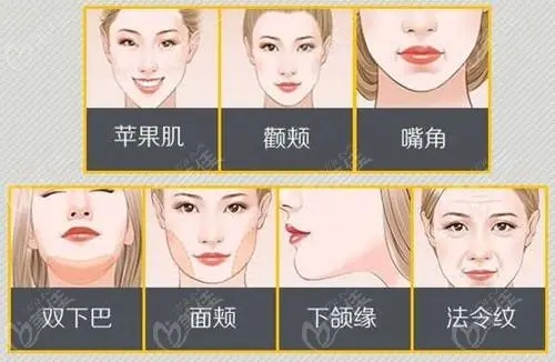 面部吸脂的價(jià)格是多少?果好嗎?