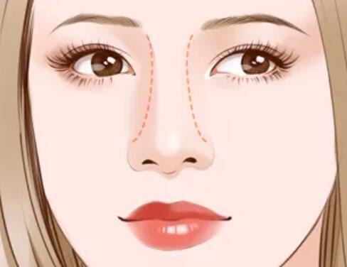 哪些情況適合鼻孔縮?。?></a>
								</div>
								<div   id=