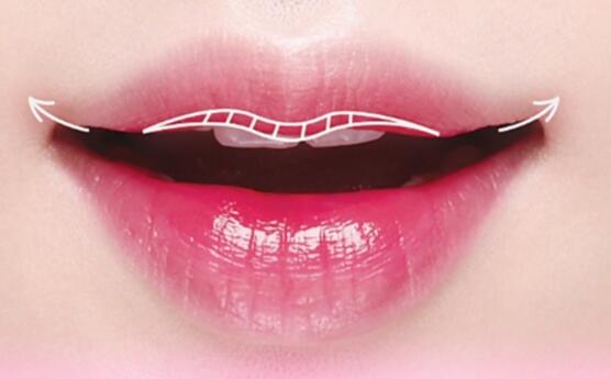 為什么不能做唇系帶手術(shù)?