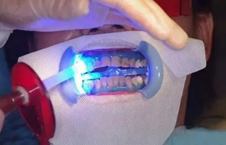 激光美白后如何護理？激光美白后需要注意什么?