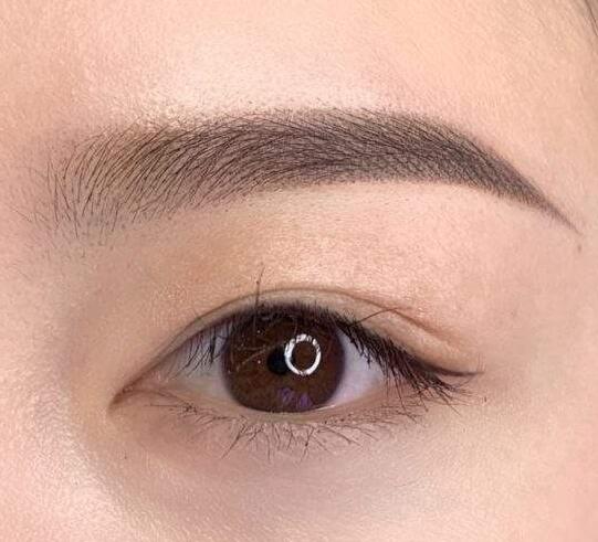 切眉手術(shù)術(shù)后要注意什么?