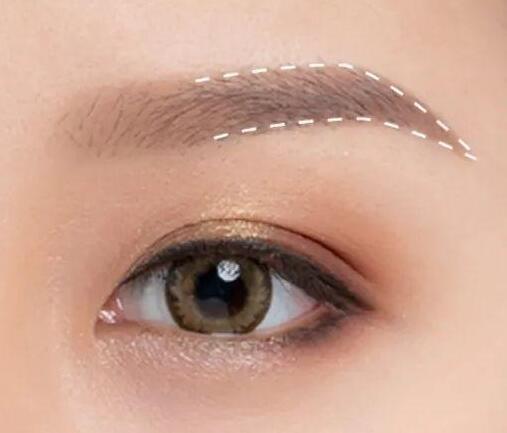 切眉術(shù)的方式有哪些?切眉術(shù)有哪些優(yōu)勢(shì)?