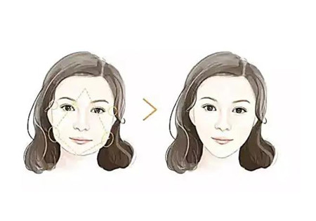 下頜角整形手術(shù)的效果和哪些因素有關(guān)系嗎?