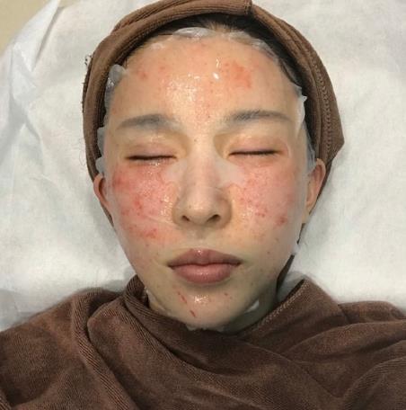 西安唐都醫(yī)院整形科祛斑案例+價格同時奉上！附口碑攻略