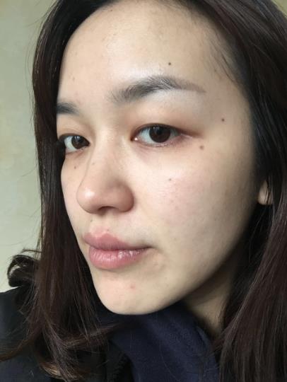 南昌大學(xué)第一附屬醫(yī)院整形哪個(gè)醫(yī)生好？涂峻、肖樂(lè)強(qiáng)攜價(jià)格表、案例對(duì)比！