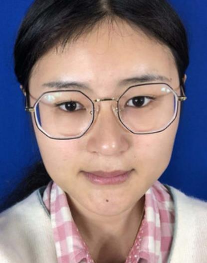 北京八大處磨骨整形項目價格表（案例）附唐勇&胡金天預(yù)約入口