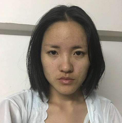 福州海峽城醫(yī)院拉皮案例(除皺價(jià)格表)+林沸騰等3位醫(yī)生信息介紹