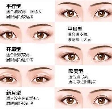 雙眼皮修復(fù)是怎么做的?雙眼皮修復(fù)注意事項盤點