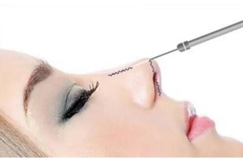 做一個鼻子的價格是多少?