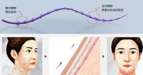 面部需要多長時(shí)間見，面部缺點(diǎn)介紹