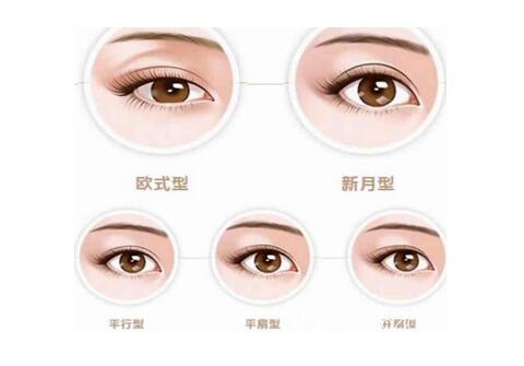 眼睛雙眼皮可以修幾次?雙眼皮修復(fù)注意事項?