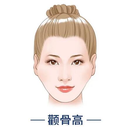 什么是顴弓降低？