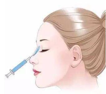 注射式隆鼻好不好?能維持多久?