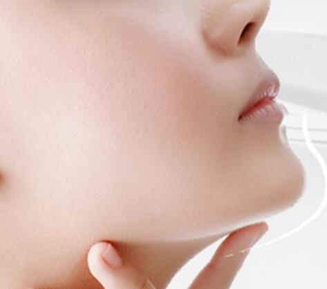 玻尿酸墊下巴后遺癥