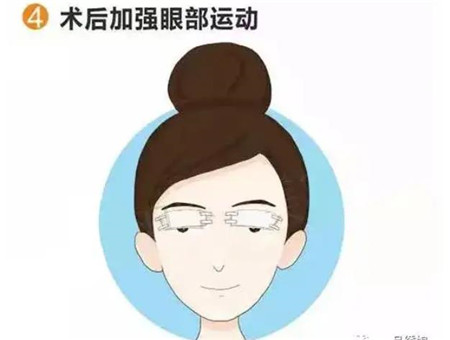 雙眼皮手術(shù)有哪些缺點以及怎么護理