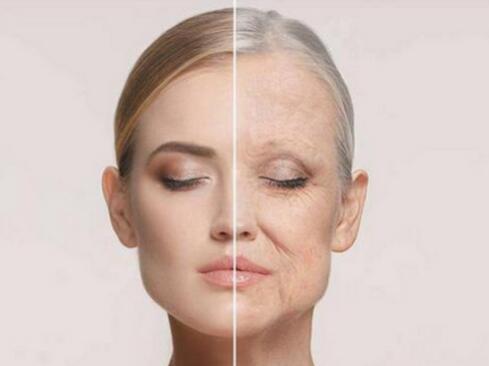 祛皺得花多少錢?哪些方法比較便宜?