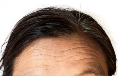 去抬頭紋價格大概要多少錢?