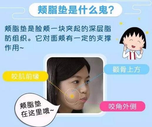 去頰脂墊價(jià)格貴嗎?大概價(jià)位是多少?