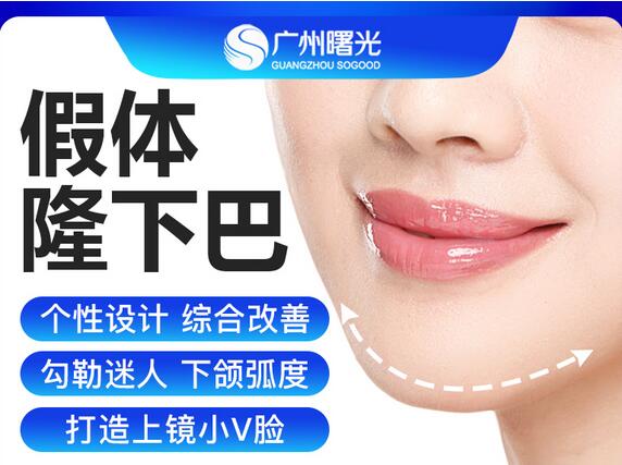 膨體隆下巴多久消腫?有后遺癥嗎?